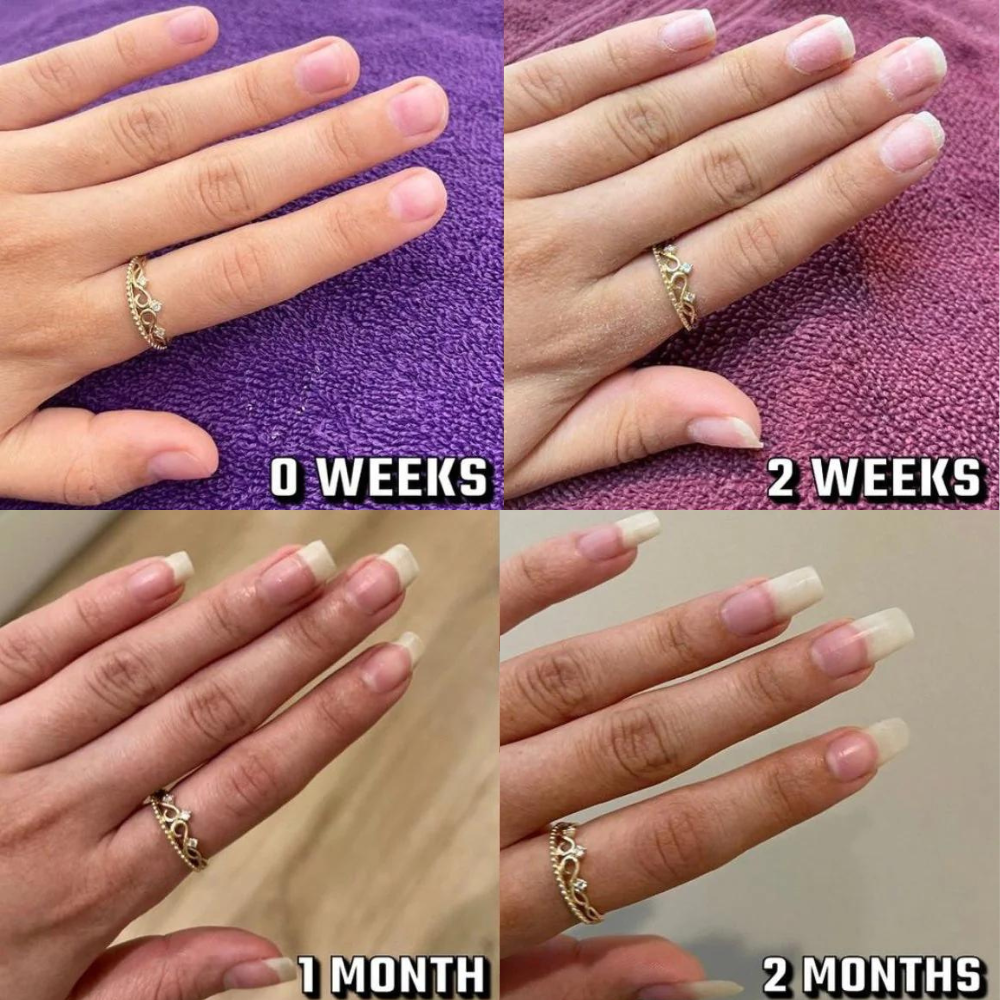 Nail Growth Serum (Cuticle's Oil)