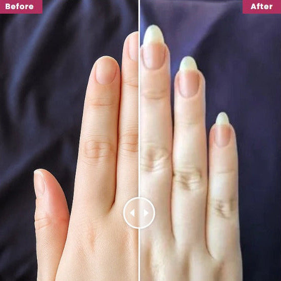 Nail Growth Serum (Cuticle's Oil)