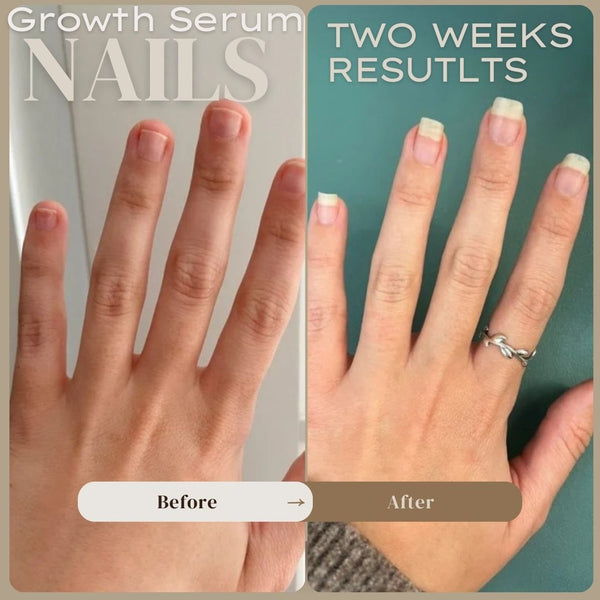 Nail Growth Serum (Cuticle's Oil)