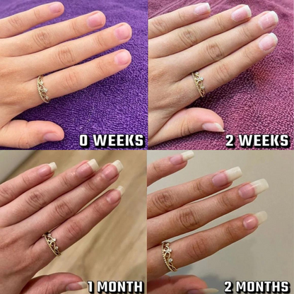 Nail Growth Serum (Cuticle's Oil)