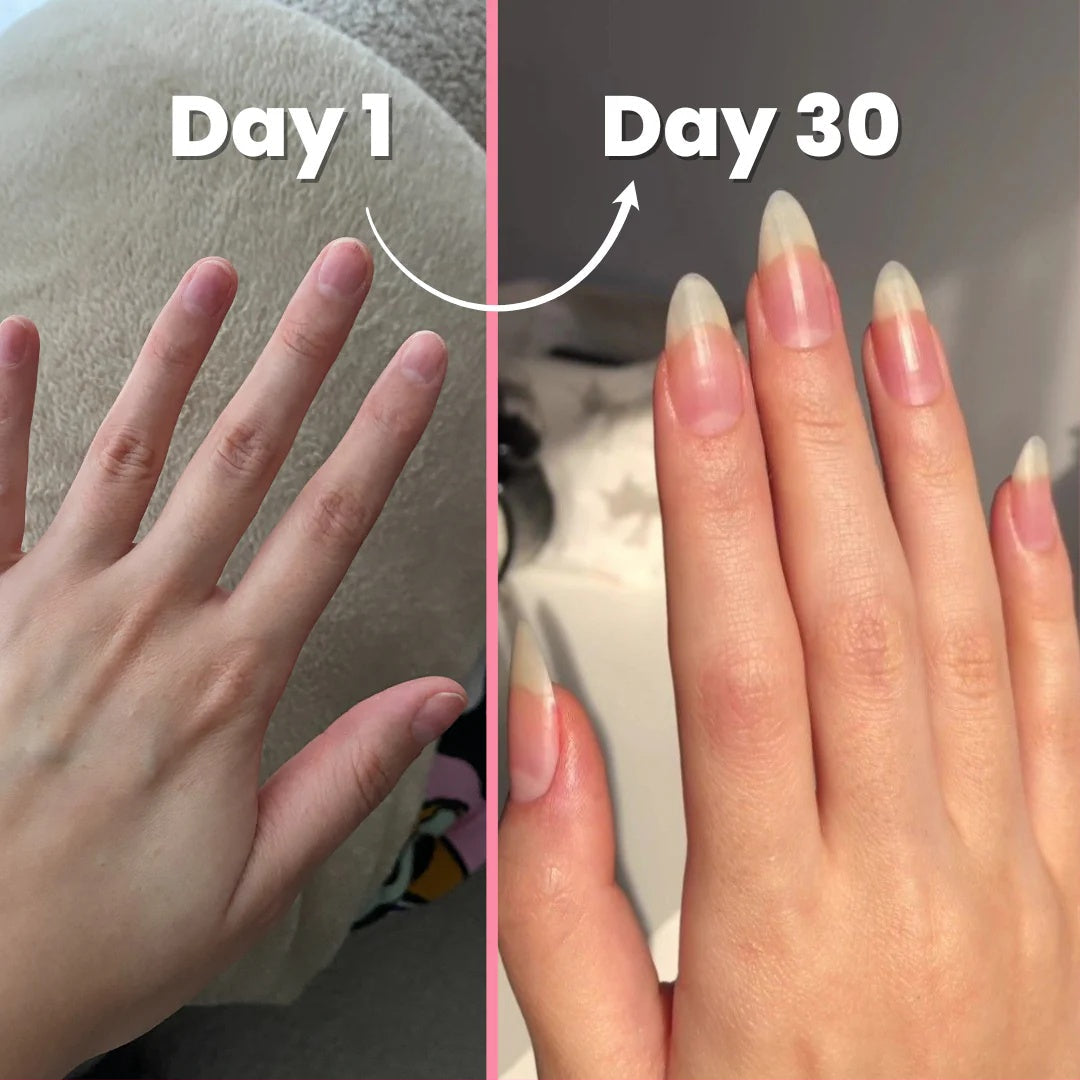 Nail Growth Serum (Cuticle's Oil)