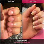 Nail Growth Serum (Cuticle's Oil)
